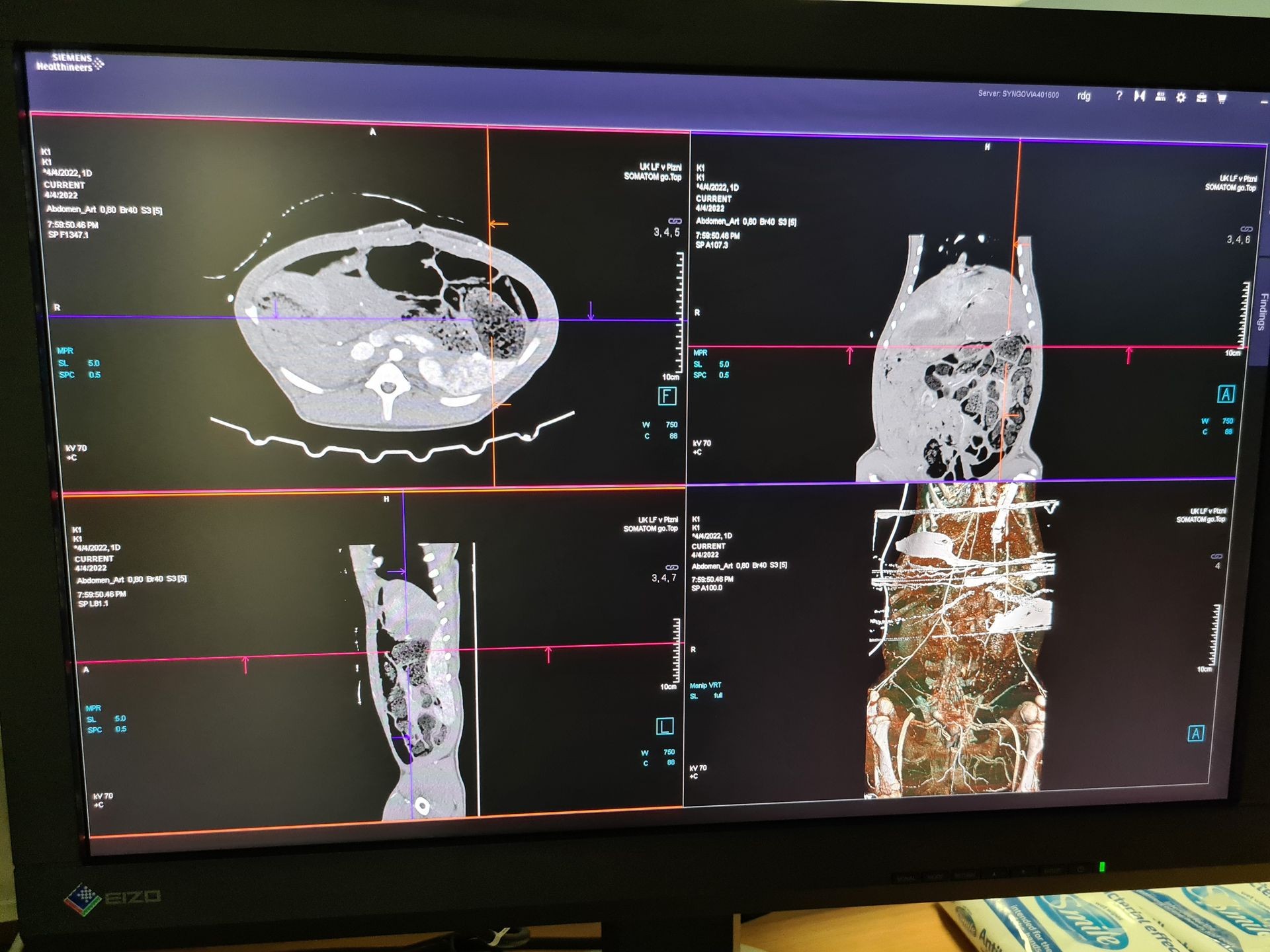 Imaging Technologies